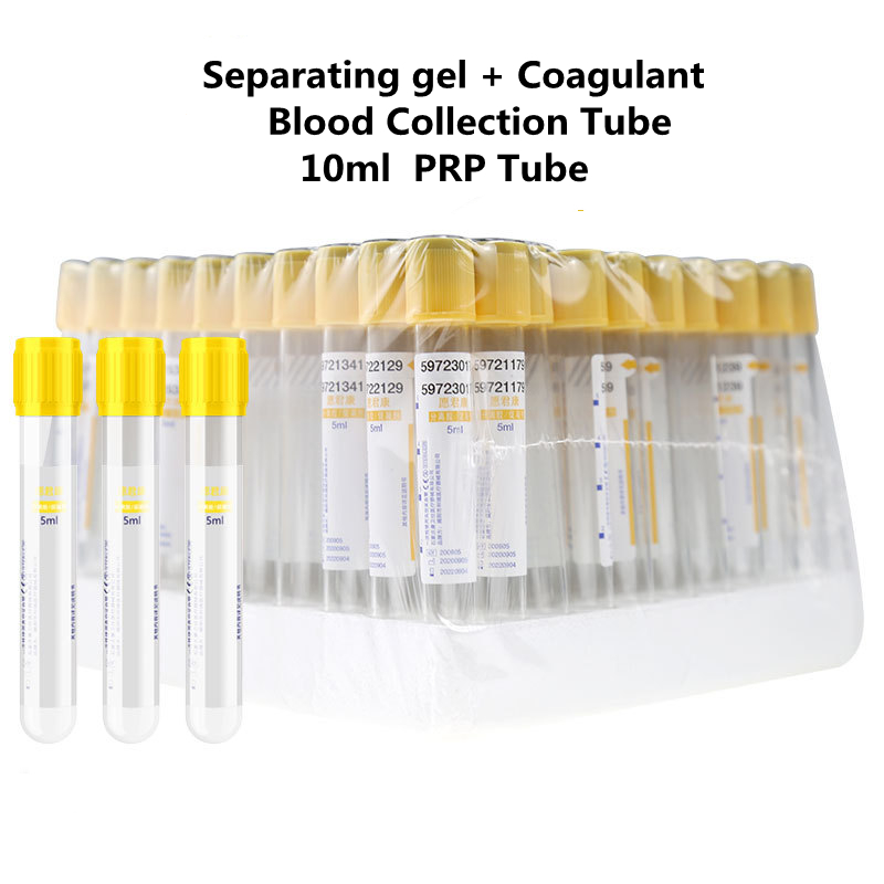 Medical Lab Blood Test - المتاح فراغ جمع الدم أنبوب فصل
