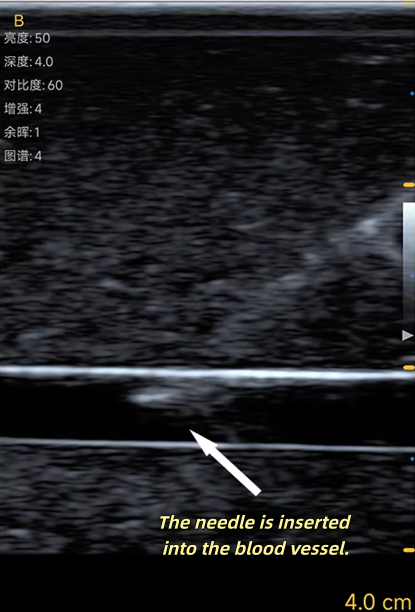 نموذج تدريب على الوخز الوريدي  - مراجعة Medical Gel Ultrasound وسعره